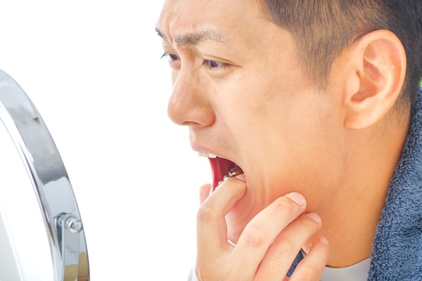 Chipped Tooth Repair Options: Bonding, Veneers, And More