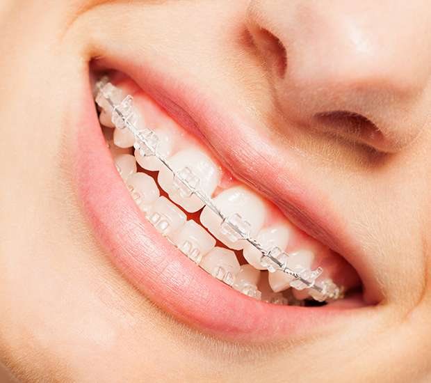 McLean Invisible Orthodontics