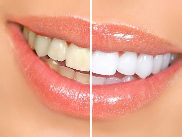 Oak Tree Dental
