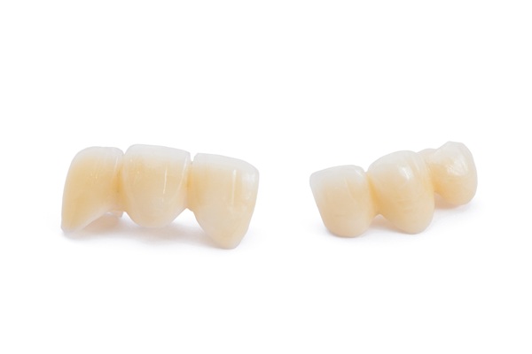 How A Dental Bridge Restores Your Smile And Improves Everyday Function