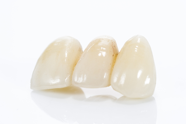 What Is A Dental Bridge And What Is It Used For?