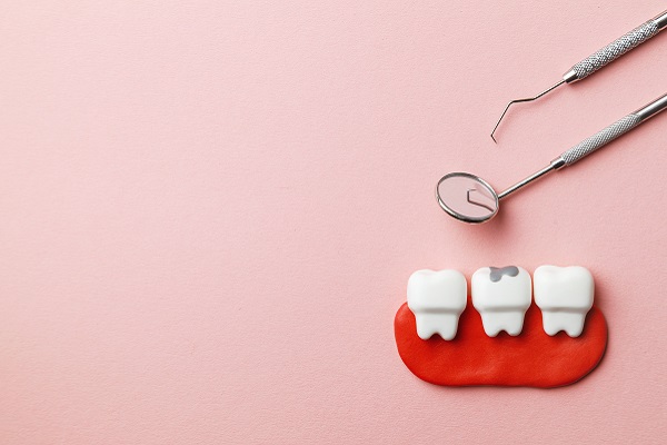 How Does A Dental Filling Fix A Cavity?