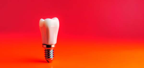 Are Dental Implants Permanent Restorations?