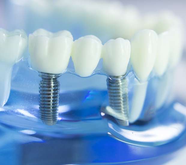 McLean Dental Prosthetics