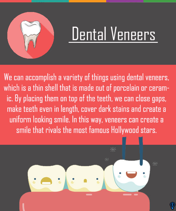 Dental Veneers and Dental Laminates McLean, VA
