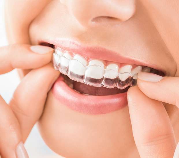 McLean Does Invisalign® Really Work?