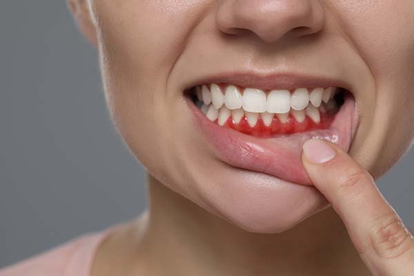 Oral Hygiene Basics: Try To Stop Gum Disease Before It Starts