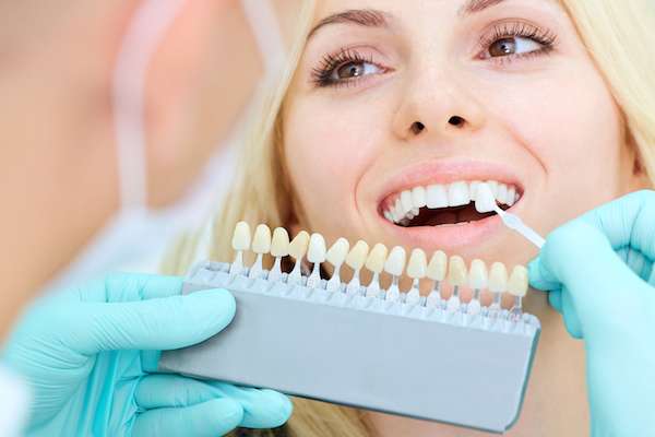 How a Cosmetic Dentist Places Dental Veneers from Oak Tree Dental in McLean, VA