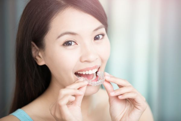 Invisalign McLean, VA