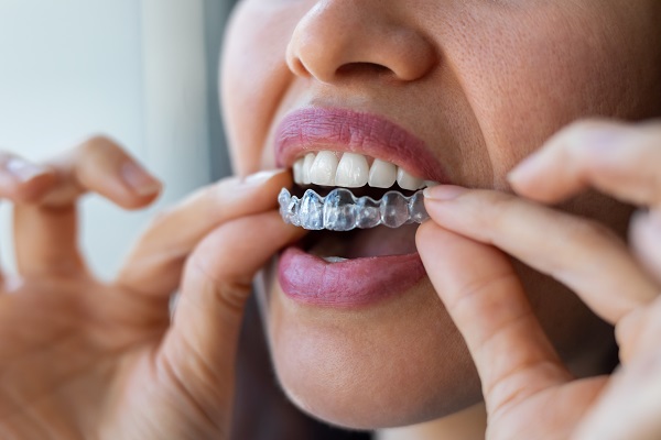 Considering Braces as An Adult? You Want to Think About Invisalign