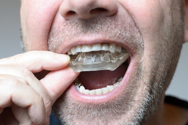 Will Bruxism Go Away On Its Own?