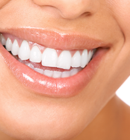 Teeth Whitening Services McLean, VA