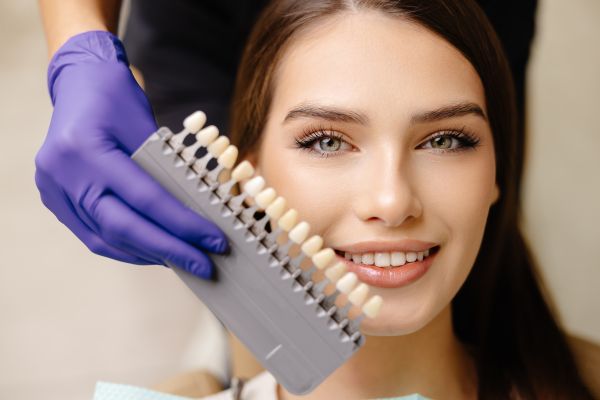 Teeth Whitening    : Your Guide To A Dazzling Smile